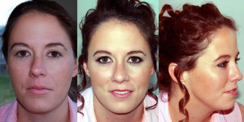 Airbrush Makeup, before and after